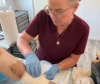 The Stages of Wound Healing Explained